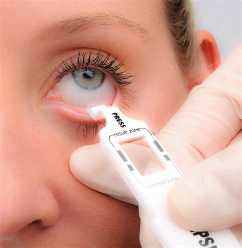 tear test for dry eyes|how to identify dry eye.